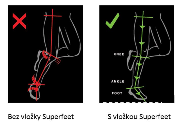 superfeet superfeet